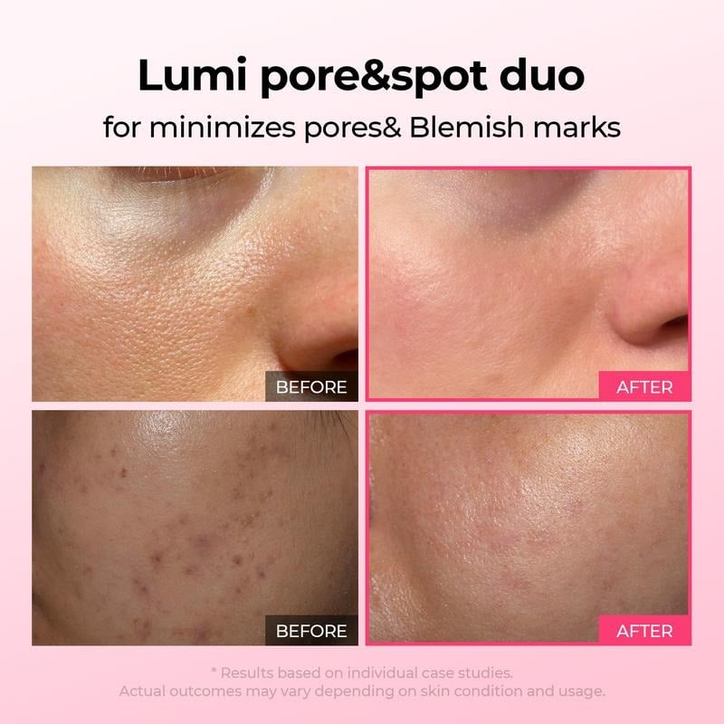 🔥Lumi Pore & Spot Care Duo | Shrinks Pores & Fades Blemish Marks