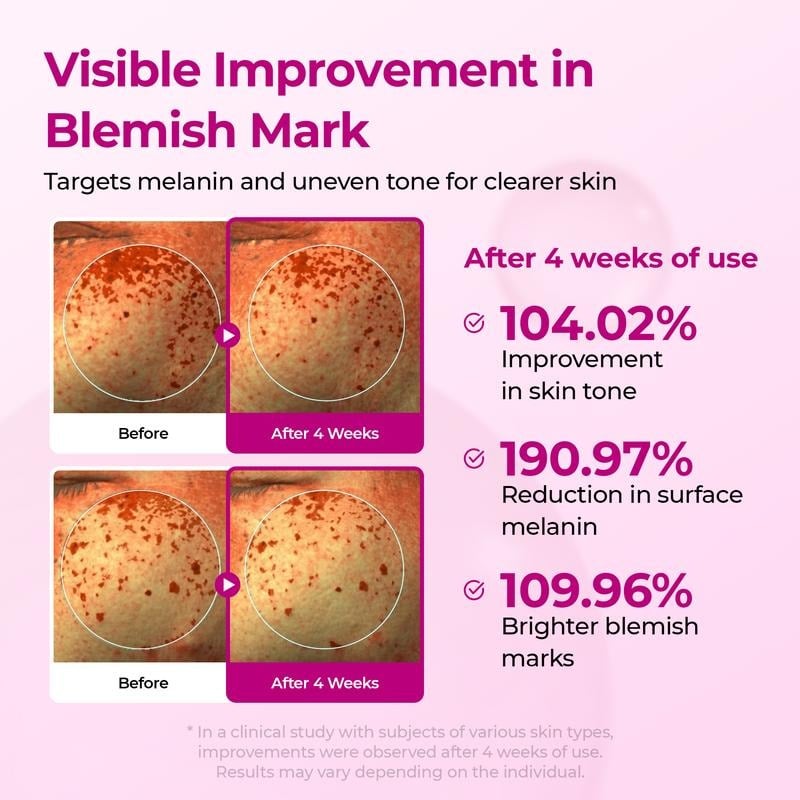 🔥Lumi Pore & Spot Care Duo | Shrinks Pores & Fades Blemish Marks