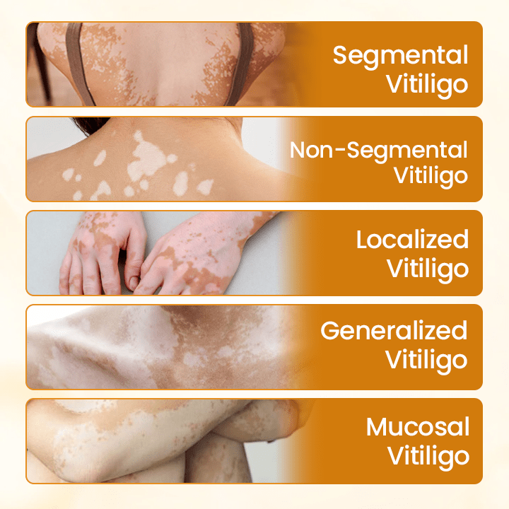 VitiClear Pro Bee Toxin Cream