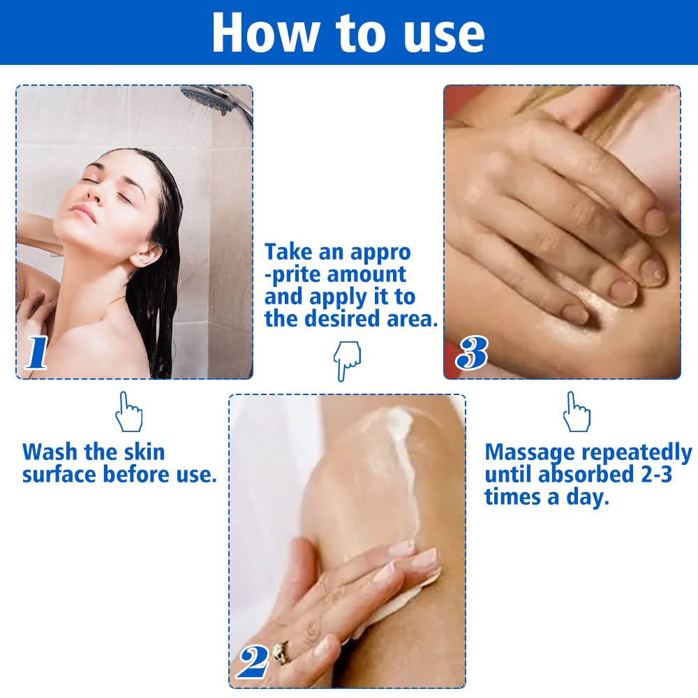 Fengyang Pack of 2 Vitiligo Skin Care Balm Vitiligo Cream Vitiligo Cream Vitiligo Cream for White Spots on the Skin Vitiligo Care Cream