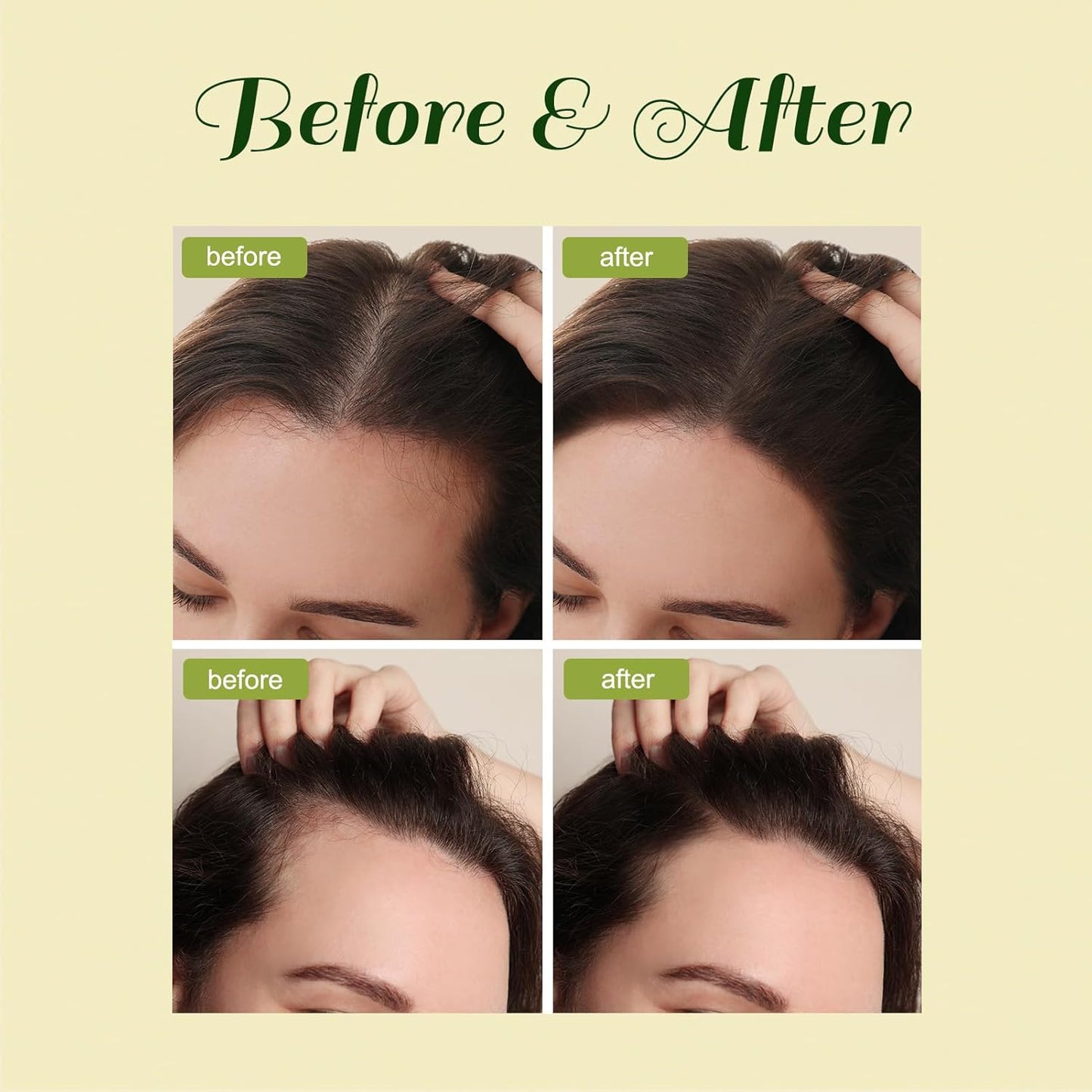 2pcs Veganic Hair Growth Oil