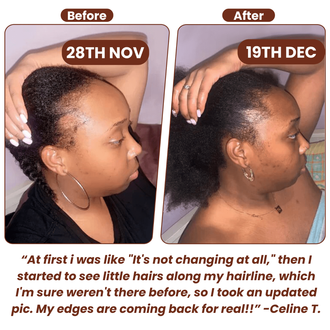 Batana Oil (Hair Growth Mix)