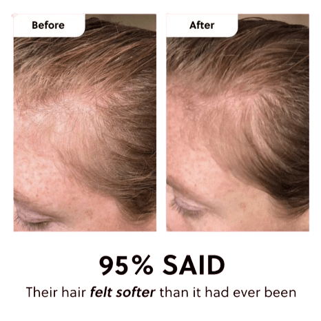Batana Oil (Hair Growth Mix)