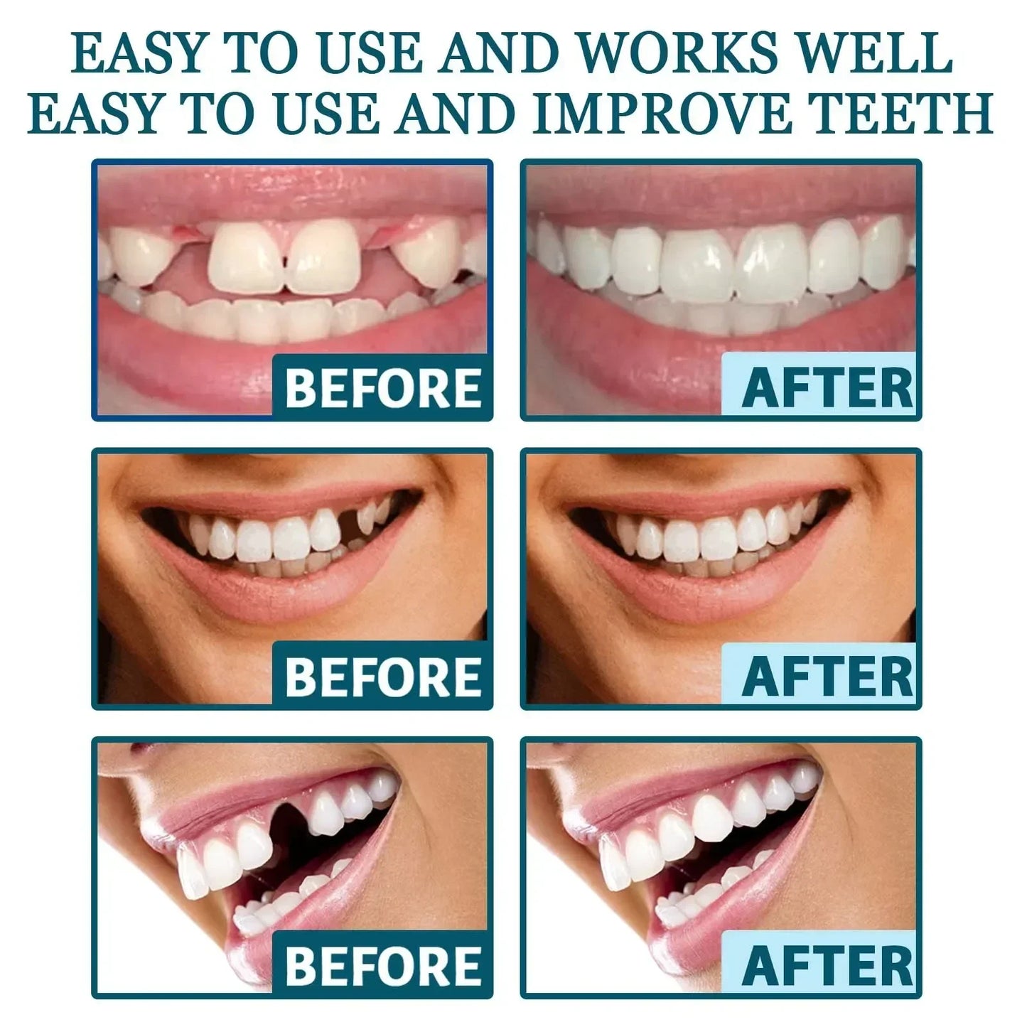Adjustable Teeth Set Whitening Dentures Perfect Smile