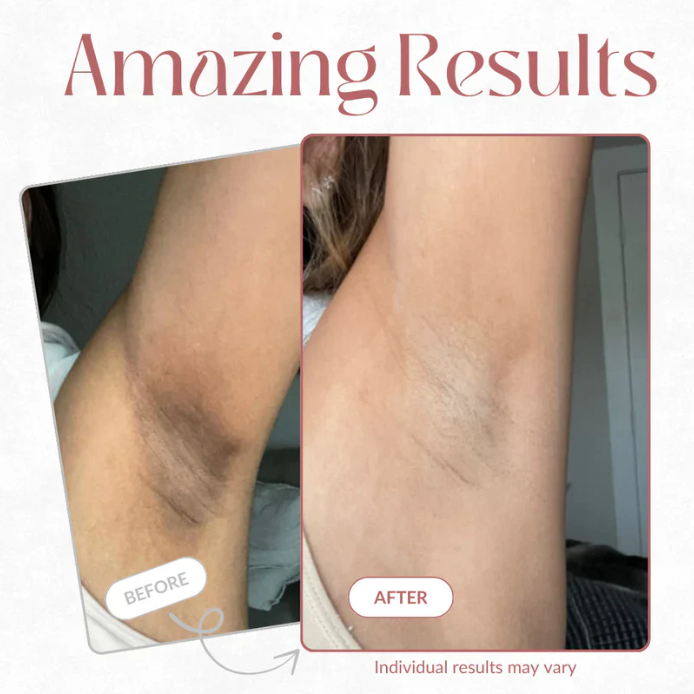 Peel Shot – Spray Corporal Exfoliante de Kojic + Cúrcuma