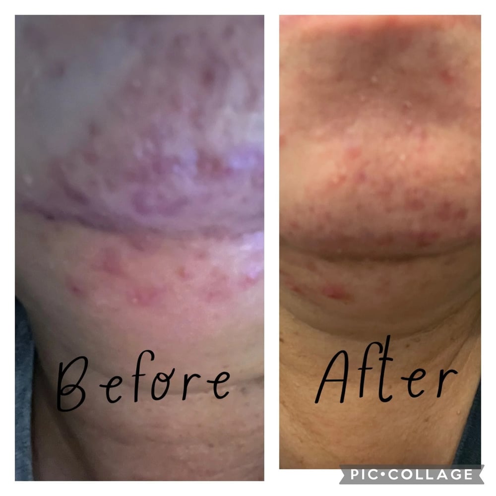 🔥Lumi Pore & Spot Care Duo | Shrinks Pores & Fades Blemish Marks