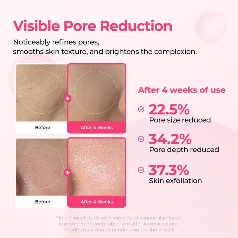 🔥Lumi Pore & Spot Care Duo | Shrinks Pores & Fades Blemish Marks
