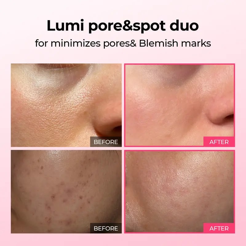 🔥This week special sales 🔥Lumi Pore & Spot Care Duo | Shrinks Pores & Fades Blemish Marks | Cyano Pink Spicule Serum + Picotonic Shot Ampoule