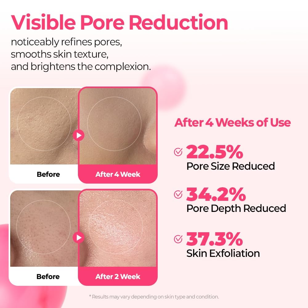 🔥This week special sales 🔥Lumi Pore & Spot Care Duo | Shrinks Pores & Fades Blemish Marks | Cyano Pink Spicule Serum + Picotonic Shot Ampoule