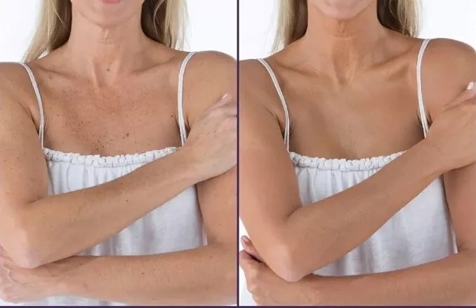 Body Coverage Perfector