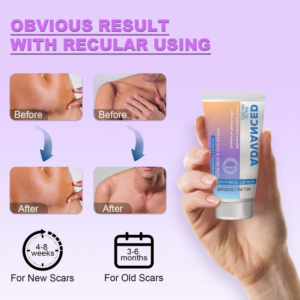 Silicone Scar Cream Scar Gel - Advanced Scar Treatment Keloid Bump Removal