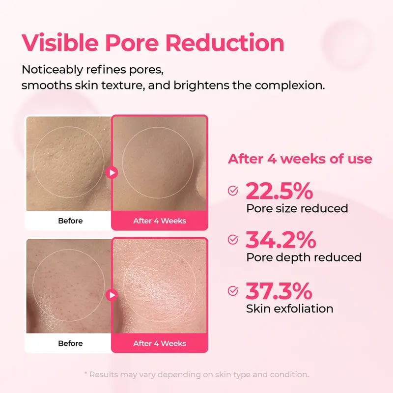 🔥This week special sales 🔥Lumi Pore & Spot Care Duo | Shrinks Pores & Fades Blemish Marks | Cyano Pink Spicule Serum + Picotonic Shot Ampoule