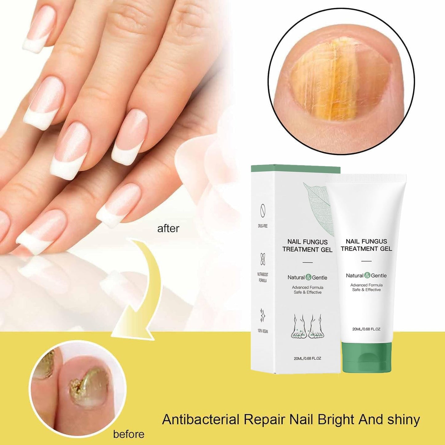 Natural Nail Fungus Treatment Gel - Fungus Cream, Multi-Purpose Nail Repair