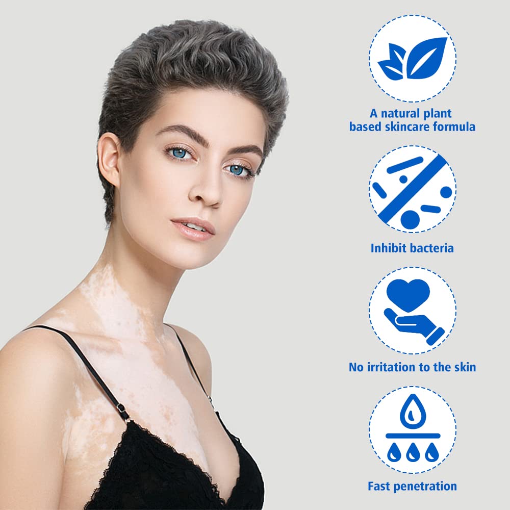 Fengyang Pack of 2 Vitiligo Skin Care Balm Vitiligo Cream Vitiligo Cream Vitiligo Cream for White Spots on the Skin Vitiligo Care Cream
