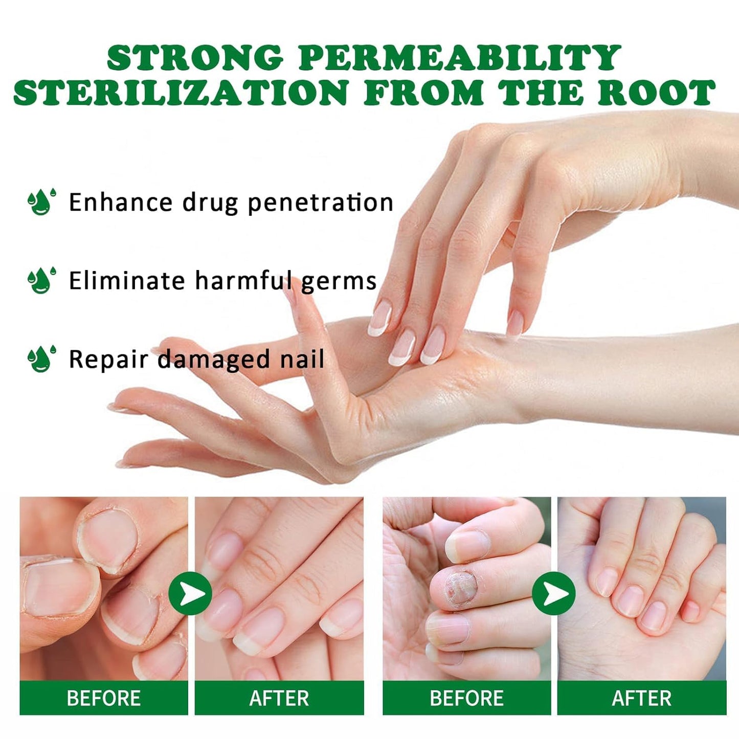 Natural Nail Fungus Treatment Gel - Fungus Cream, Multi-Purpose Nail Repair