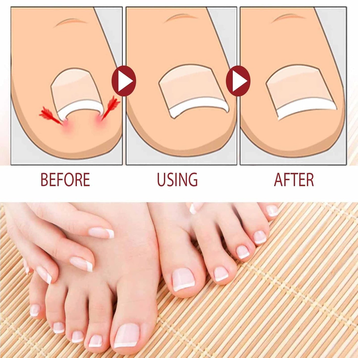 Natural Nail Fungus Treatment Gel - Fungus Cream, Multi-Purpose Nail Repair