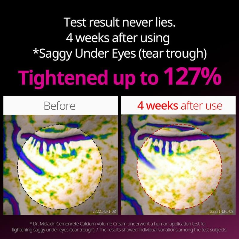 Calcium Intense Anti-aging Cream