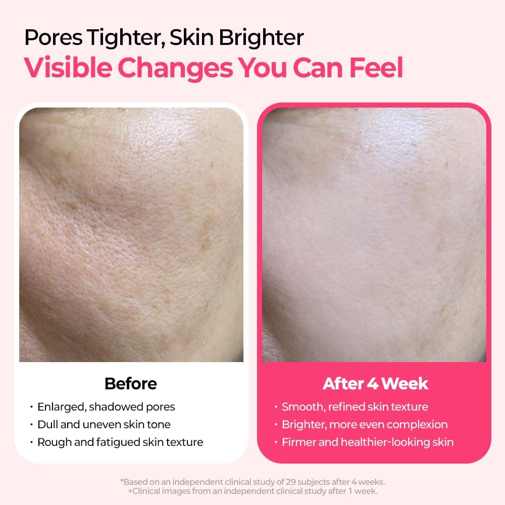 🔥This week special sales 🔥Lumi Pore & Spot Care Duo | Shrinks Pores & Fades Blemish Marks | Cyano Pink Spicule Serum + Picotonic Shot Ampoule