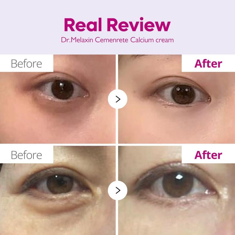 Cemenrete Calcium Intense Anti-aging Cream