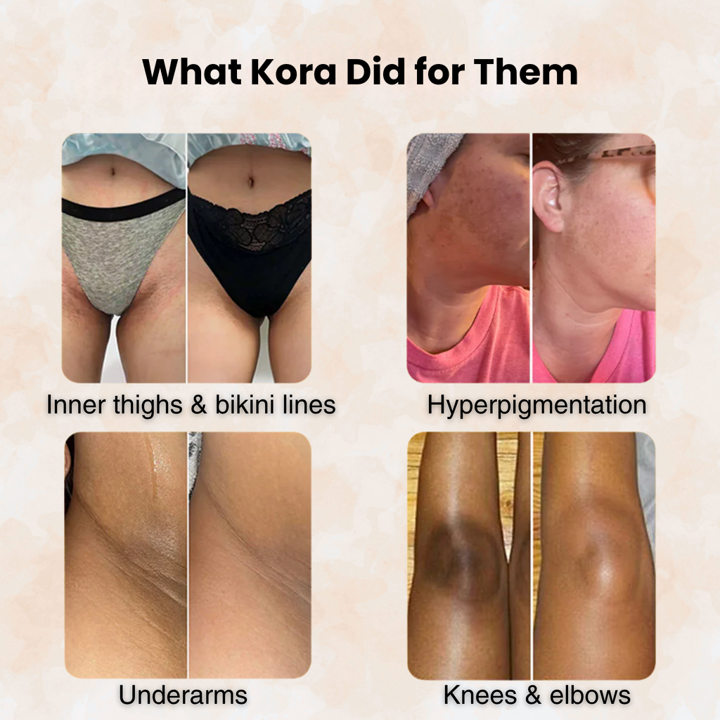 Turmeric & Kojic Acid - Skin Brightening Soap