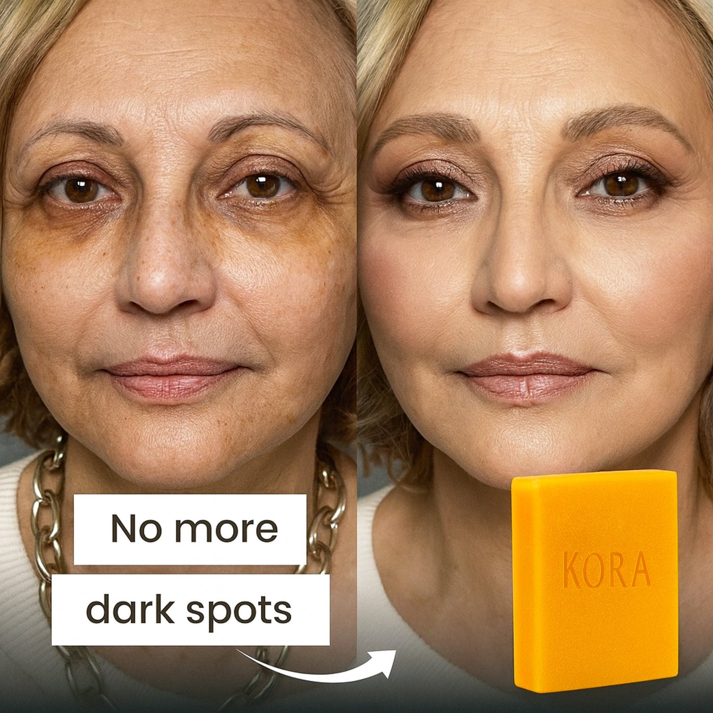 Turmeric & Kojic Acid - Skin Brightening Soap