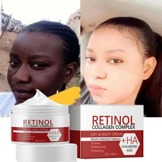 3 in1 Remove Dark Spots Cream