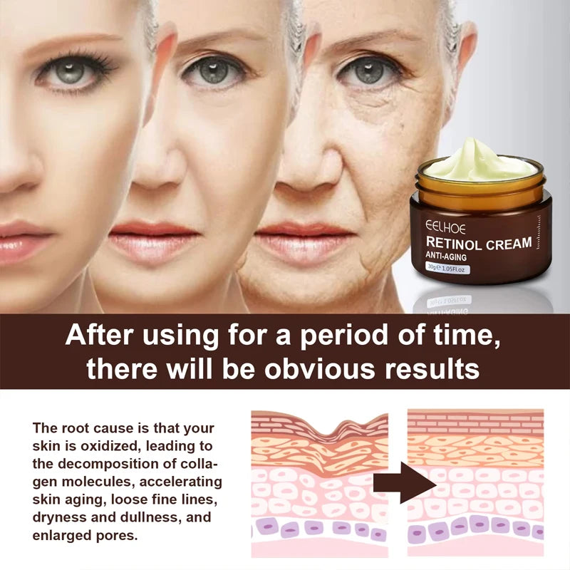 Retinol Wrinkle Remover Face Cream  Anti Aging