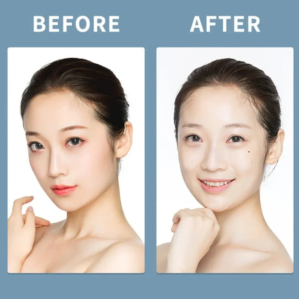 Makeup Remover