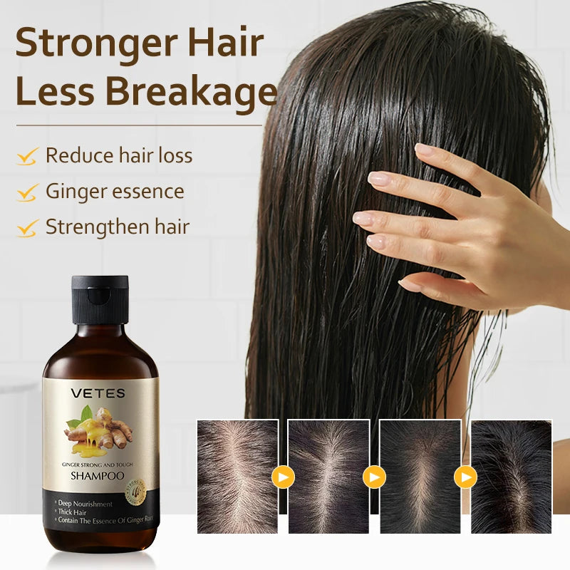 Vetes Shampoo and Shower Gel 260ml Oil-Control Whole Body Cleaning