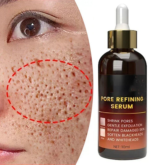 Pore Shrink Face Serum Remove Blackheads Acne