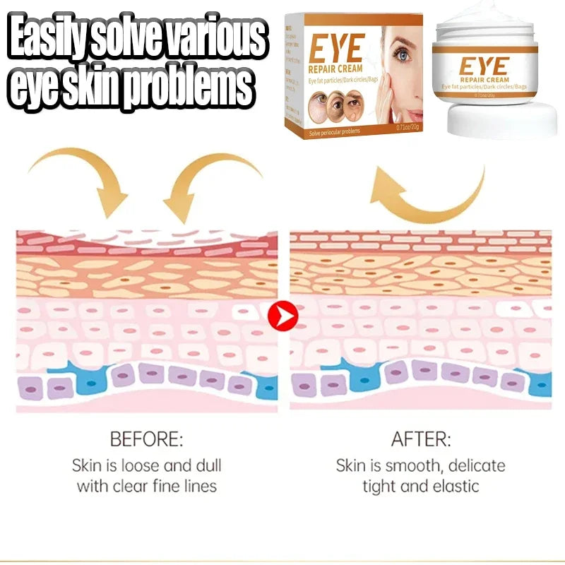 Instant Remove Wrinkle Eye Cream Eye Bags Dark Circles