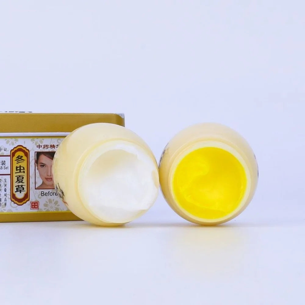 2 Pack Original Chinese Aweto Whitening Anti-Acne Day Night Cream