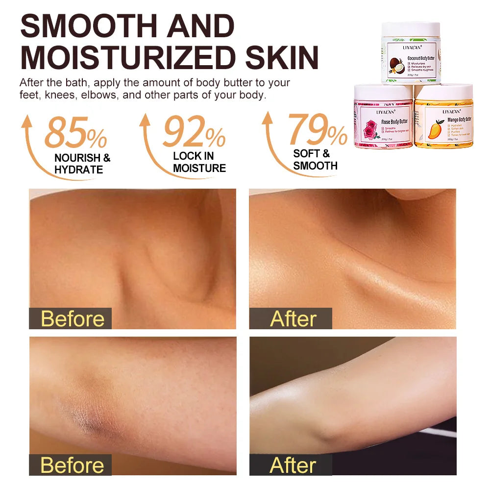 Shea Body Butter Soothes Dry Skin Nourish Moisturizer
