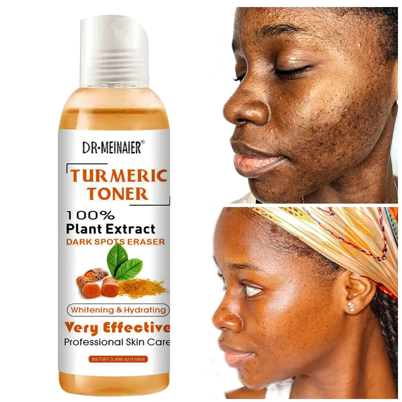 Brighten Turmeric Toner Dark Corrector Moisturizing Face Serum Vitamin C