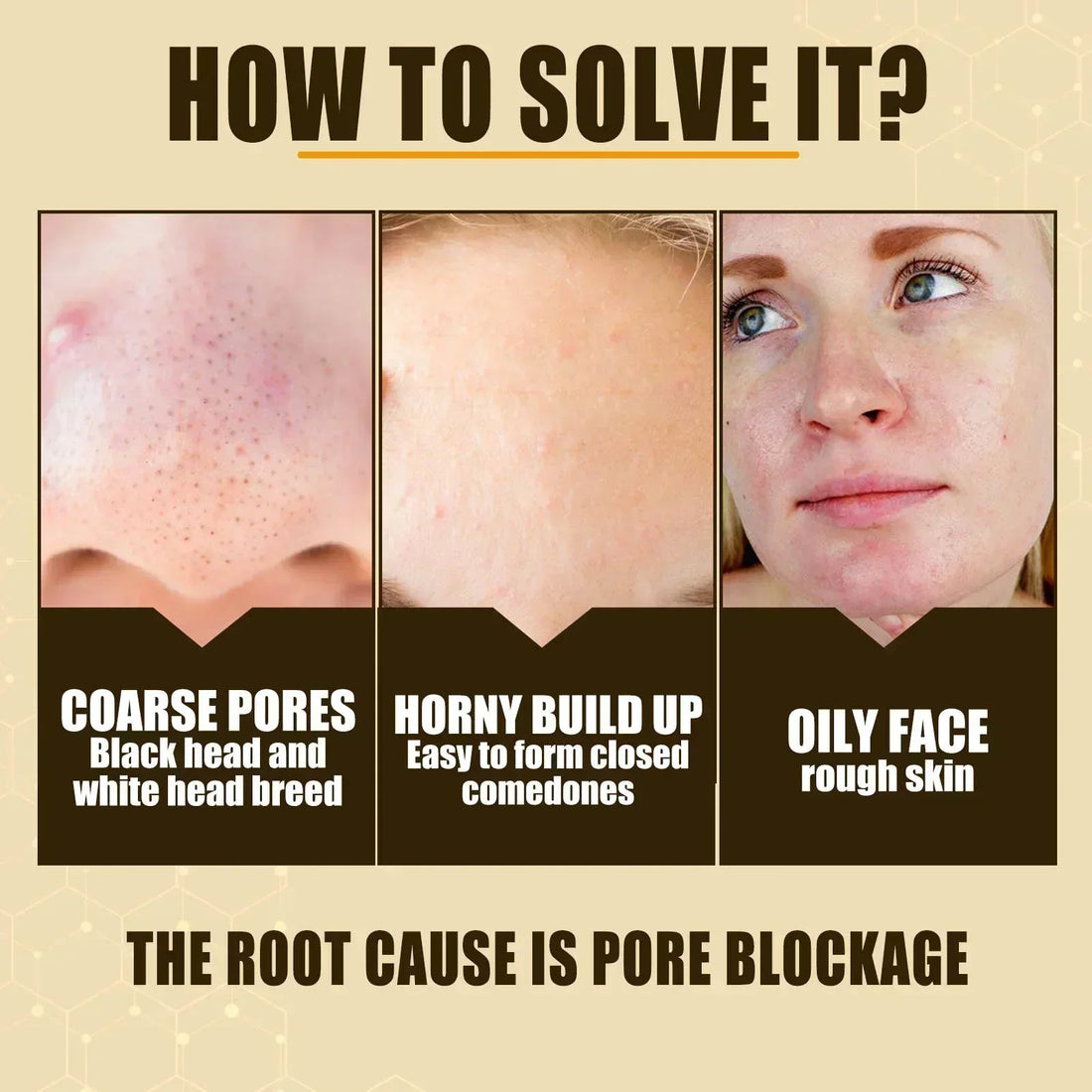Pore Shrink Face Serum Remove Blackheads Acne