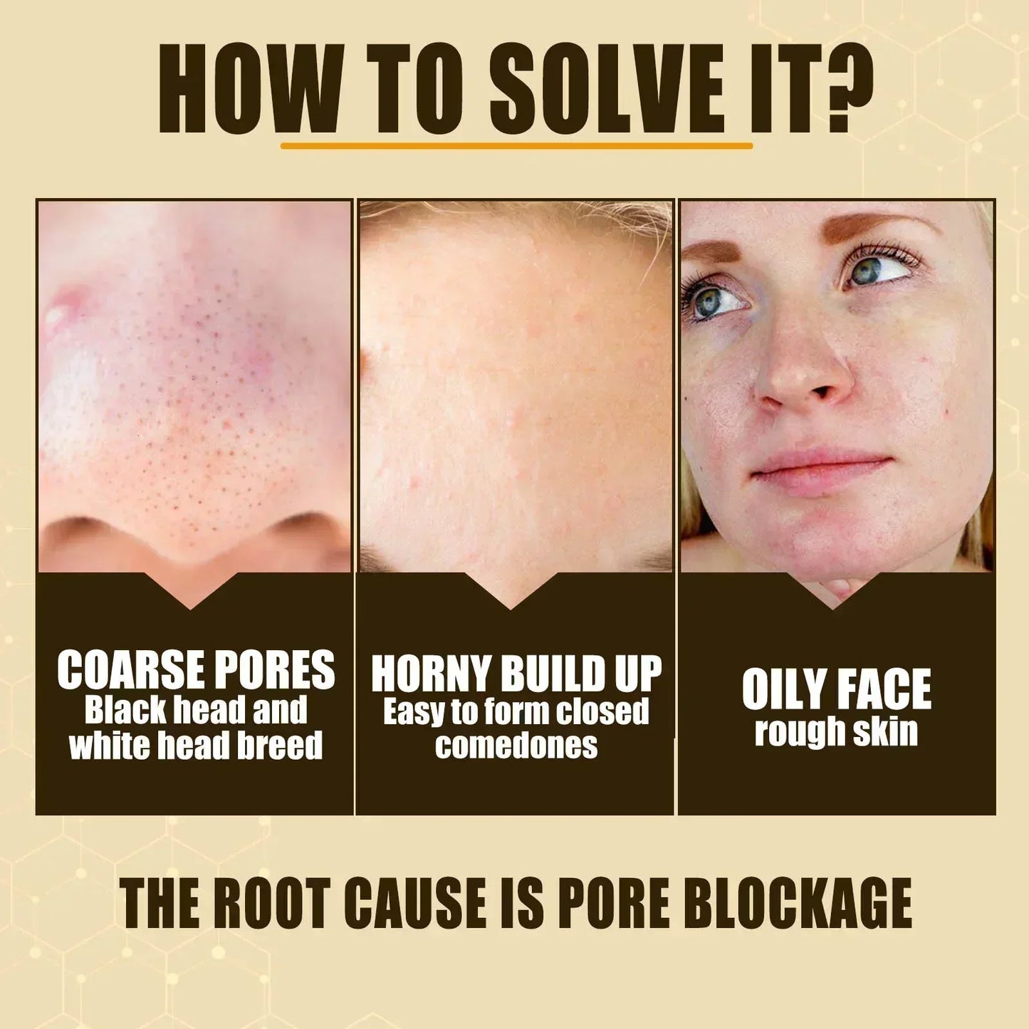 Pore Shrink Face Serum Remove Blackheads Acne