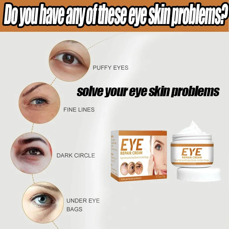 Instant Remove Wrinkle Eye Cream Eye Bags Dark Circles