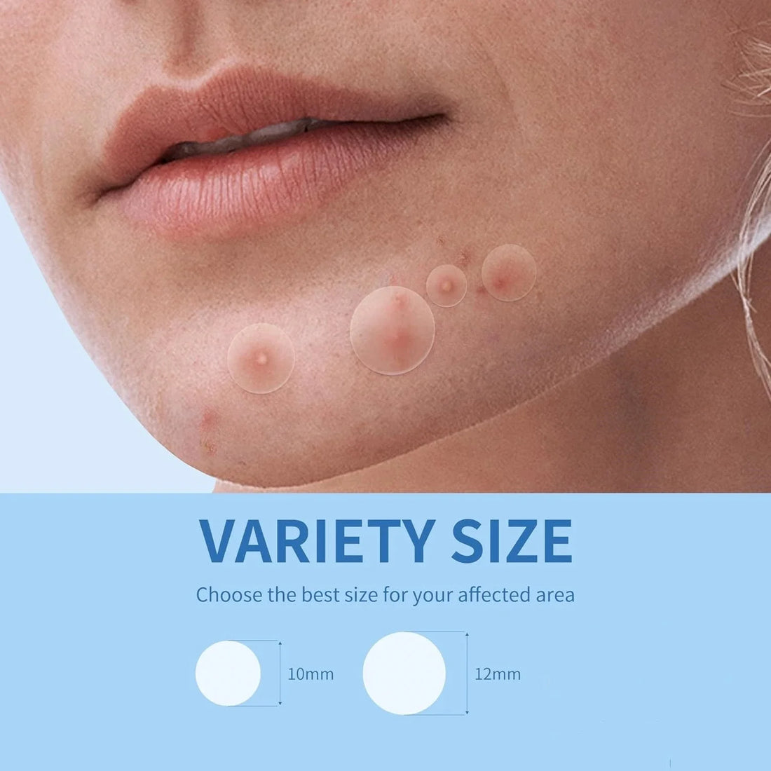 Invisible Acne Pimple Patches