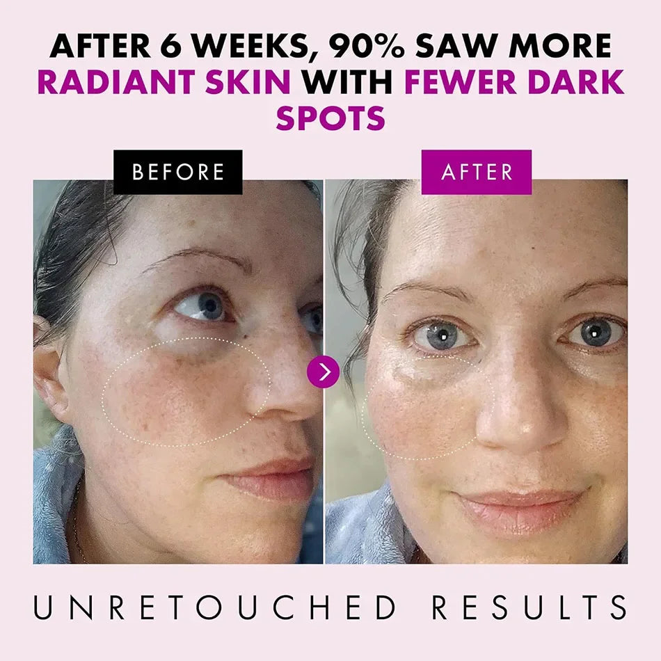 Anti Aging Whitening Wrinkle Firming Face Cream