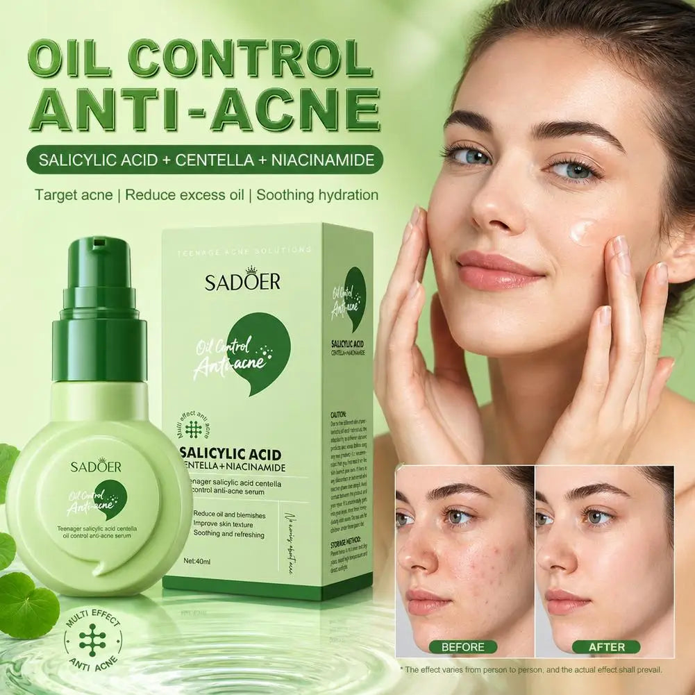 Salicylic Acid Anti-Blemish Serum