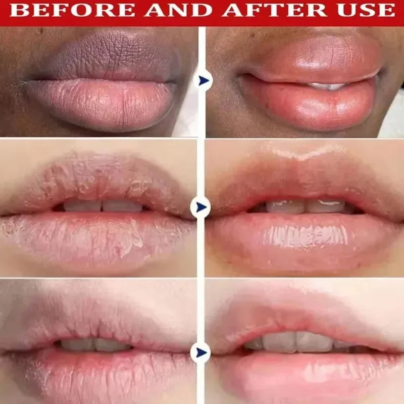 Dark Lip Balm