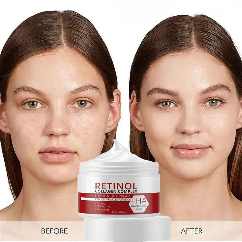 3 in1 Remove Dark Spots Cream