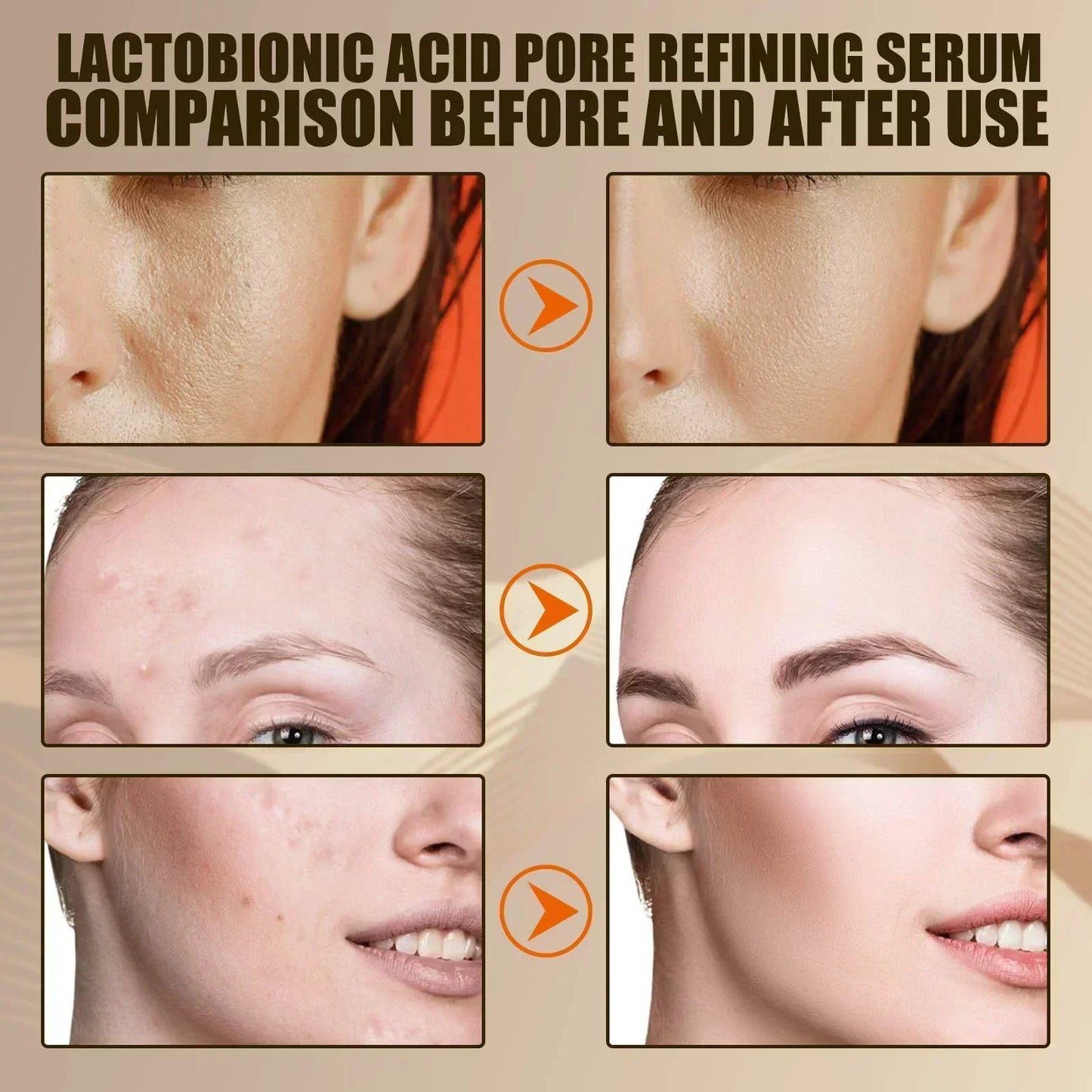 Pore Shrink Face Serum Remove Blackheads Acne