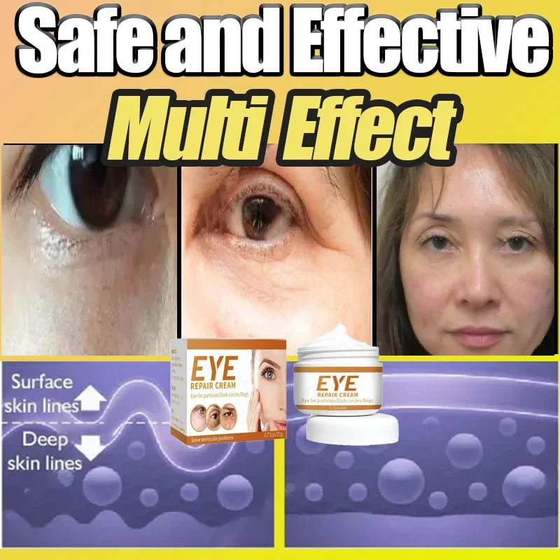 Instant Remove Wrinkle Eye Cream Eye Bags Dark Circles