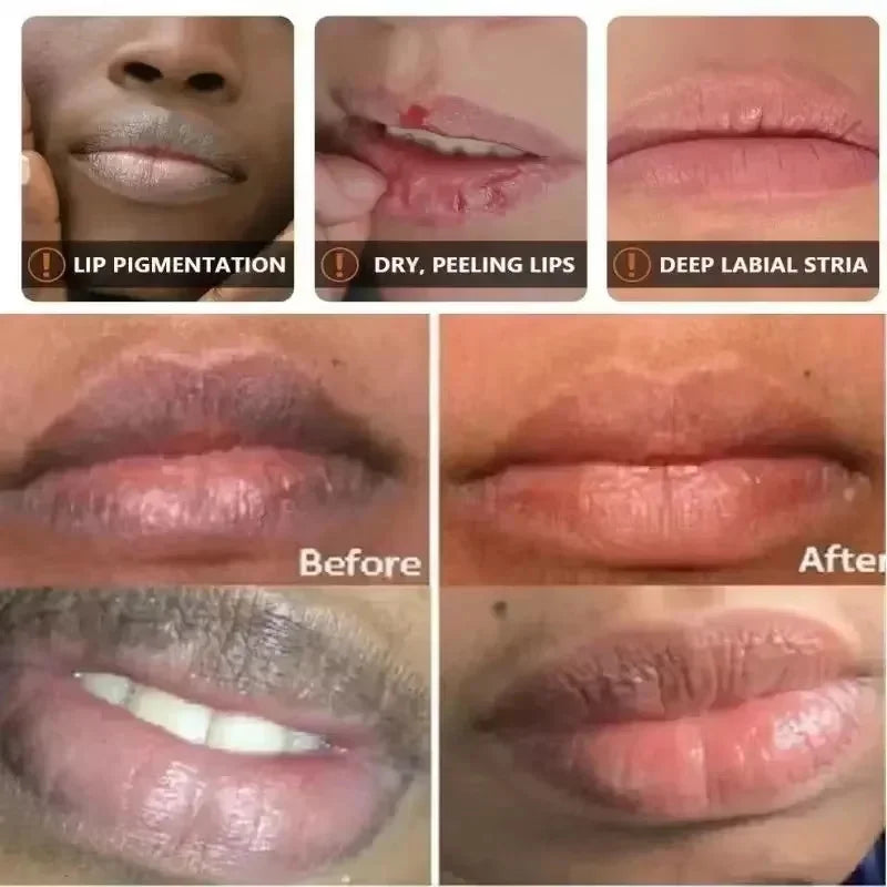 Dark Lip Balm