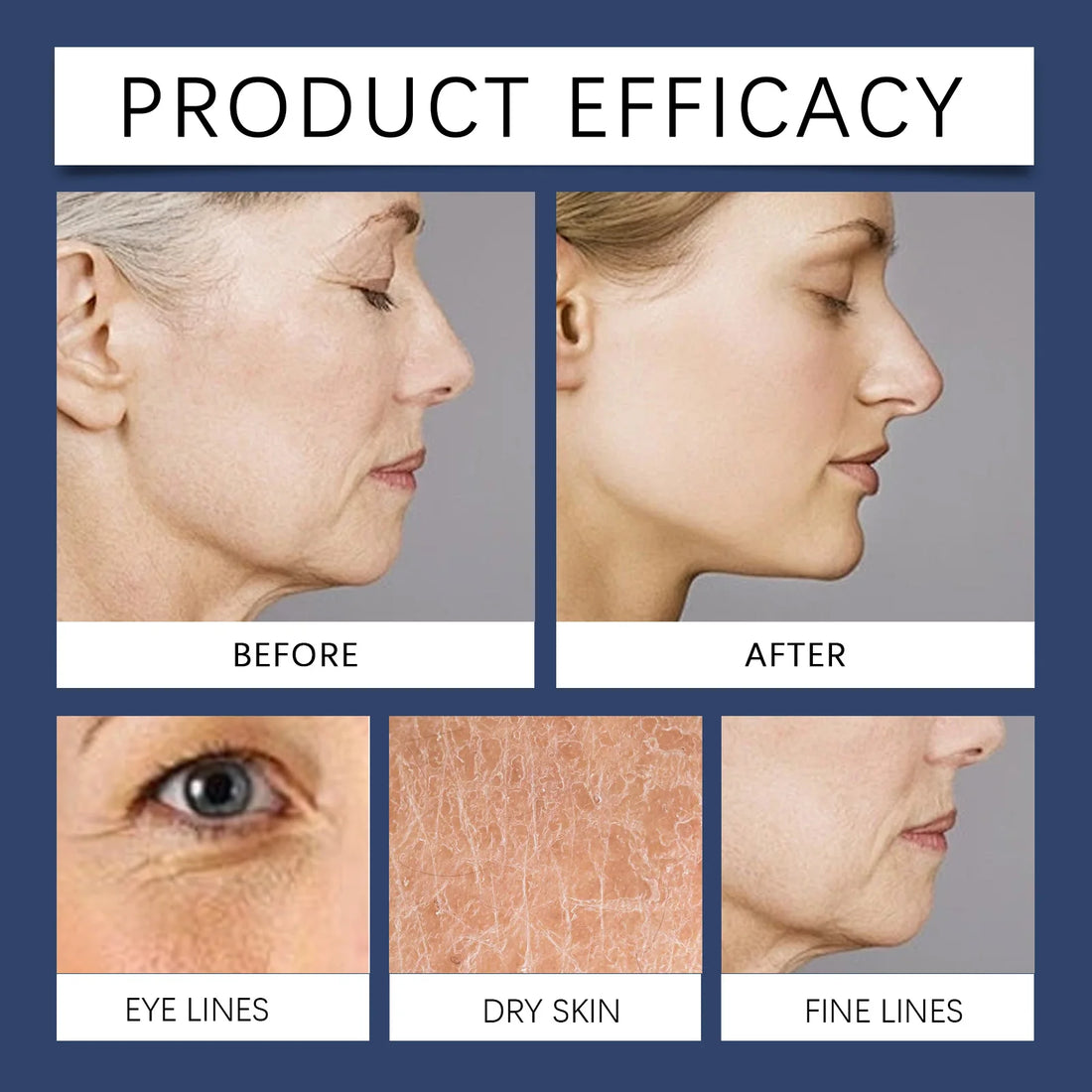 Polypeptide Firming Anti-Wrinkle Cream