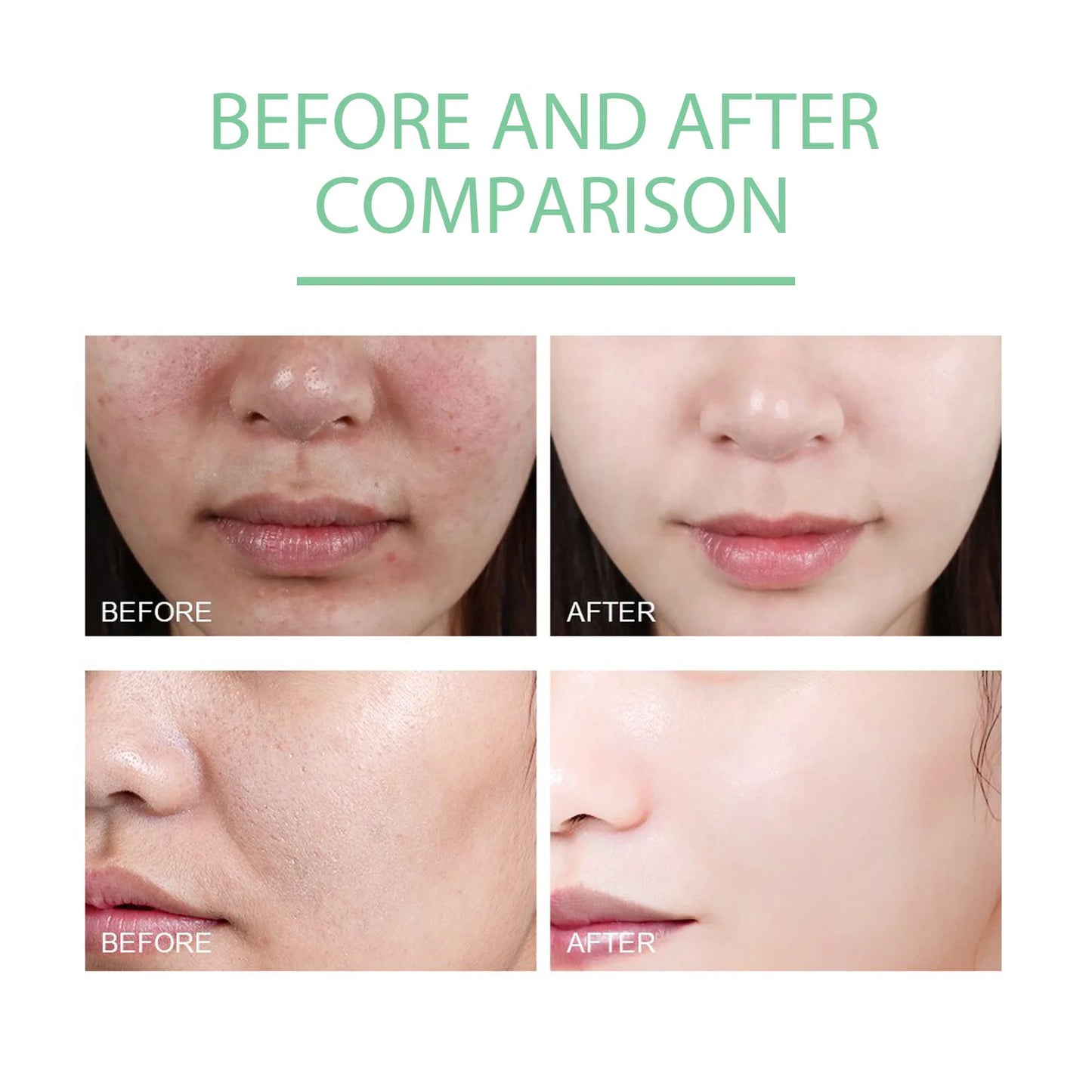 Herbal Extract Brightening Exfoliating Gel – Gentle Dead Skin Remover for Smoother, Radiant Skin