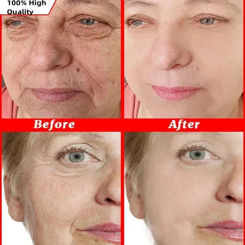 Anti Aging  Face Cream