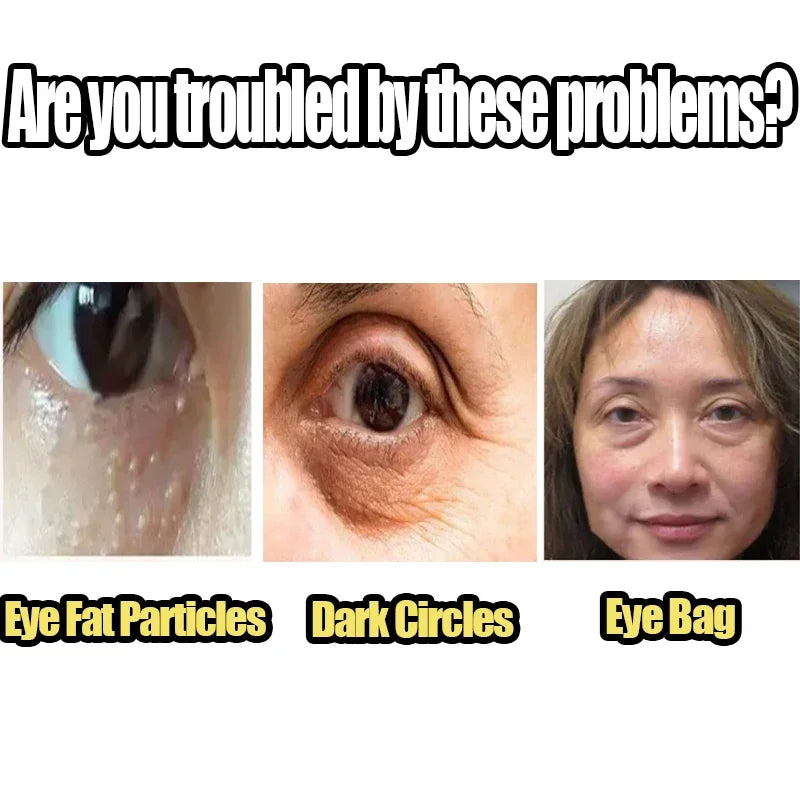 Instant Remove Wrinkle Eye Cream Eye Bags Dark Circles