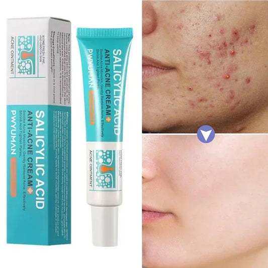 Salicylic Acid Blemish Gel Cream